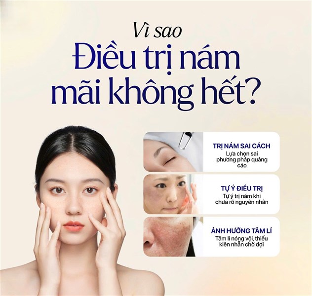 Vì Sao Trị Nám Hoài Không Hết Dù Đã Thử Nhiều Cách?