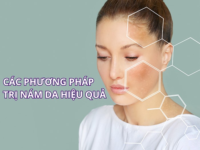 Xu Hướng Điều Trị Nám Hiện Nay Có Thật Sự Hiệu Quả?