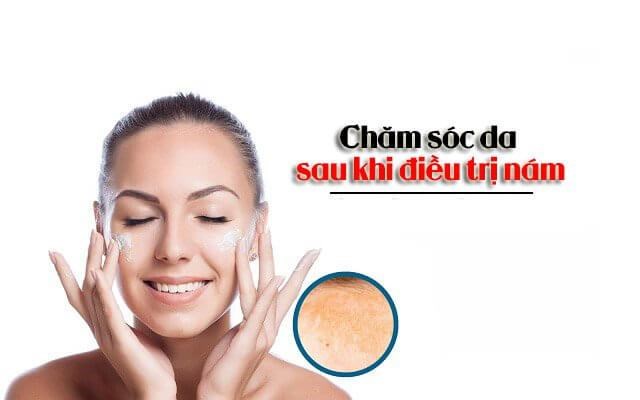 Điều kiện để nám da cải thiện bền vững và duy trì làn da sáng khỏe