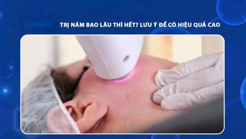 Trị nám có cần theo dõi lâu dài không? Lý do nám dễ tái phát bạn cần biết