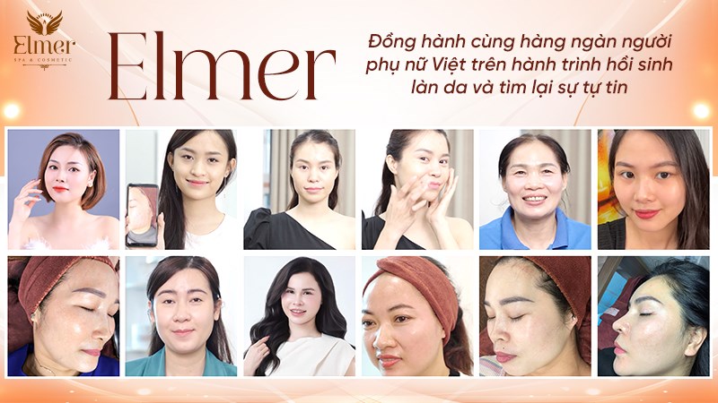 Khách hàng tại Elmer Quyên Nguyễn