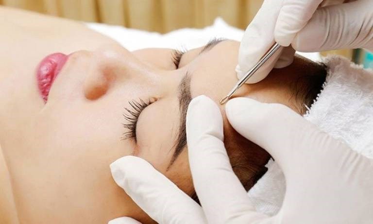 Khách hàng nhận được gì khi điều trị mụn tại Elmer Quyên Nguyễn?